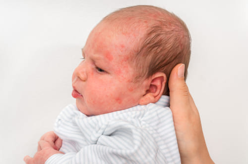 Lehigh Valley Birth Injury Lawyers